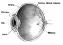 Travel India.Medical Tourism.Cataract.Human Eye.Cross sectional view